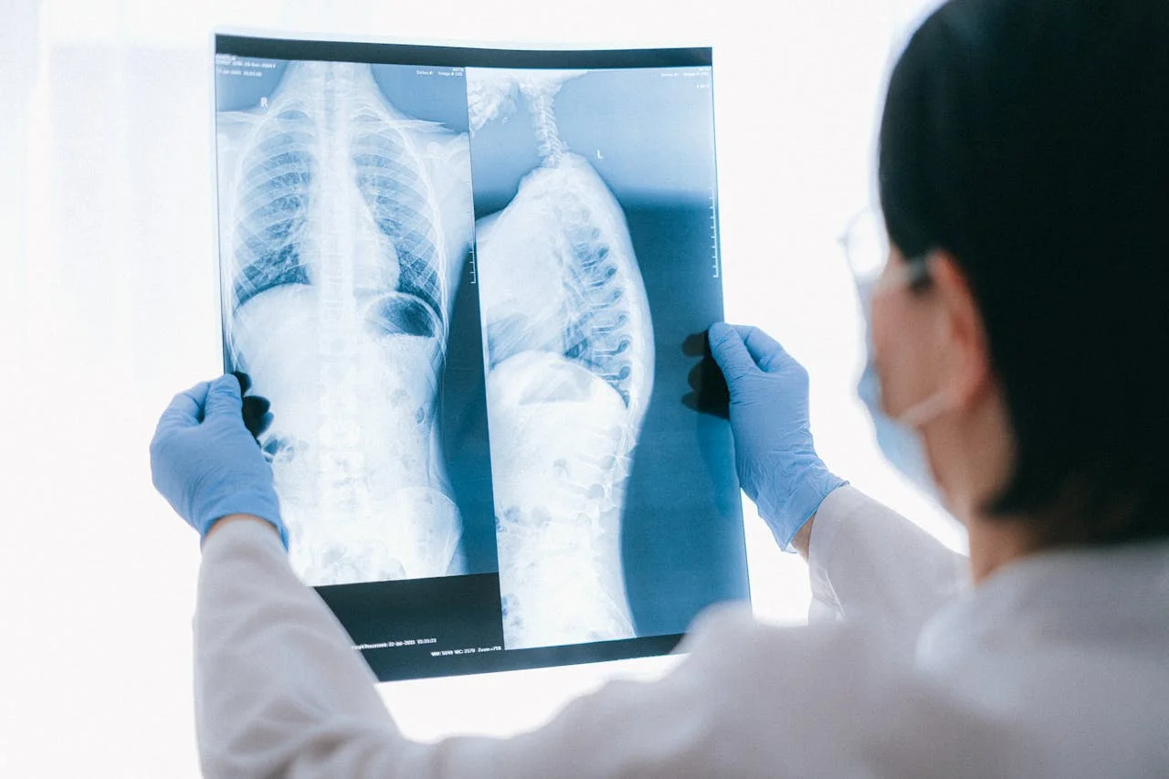 Spinal Cord Injury Legal Options and Resources in Charleston for Loved Ones